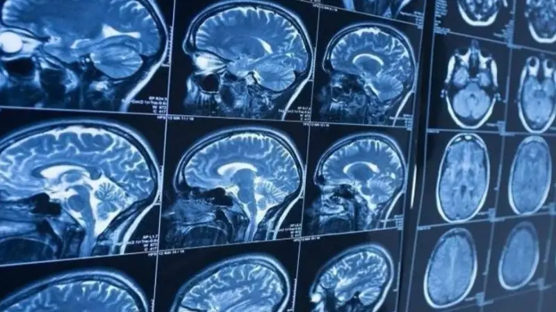 دراسة تكشف: احتمال وجود صلة بين تلف القلب والخرف