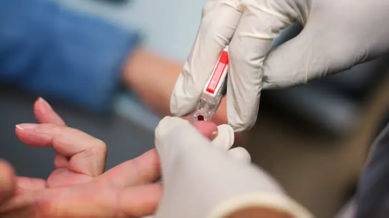 علماء يتوصلون إلى اختبار دم دقيق للتنبؤ بمسار اعتلال الكلى