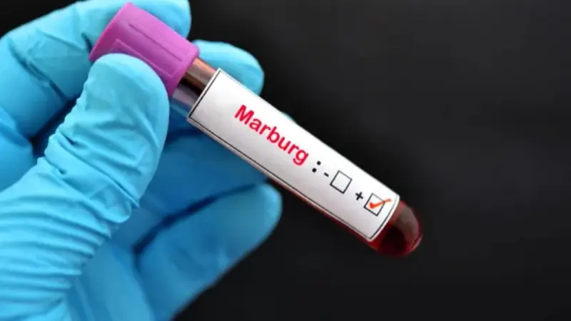 Deadly Marburg Virus: Fears of its Spread from Ethiopia to Egypt