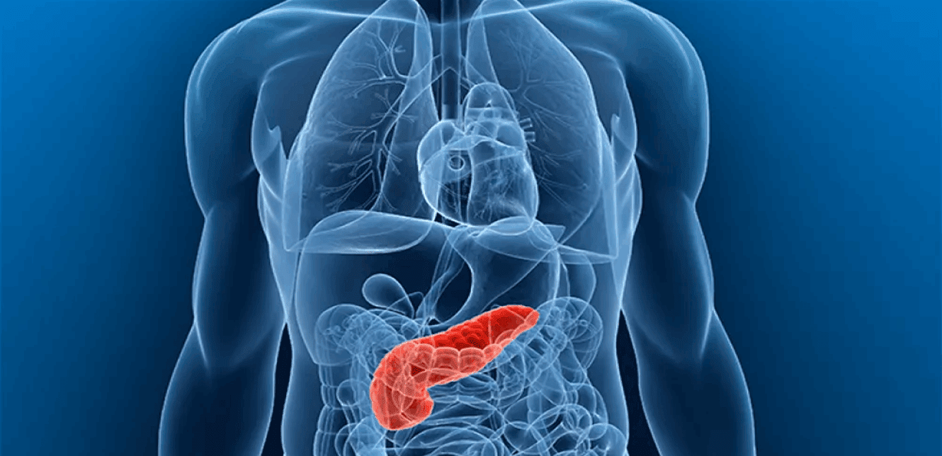 الذكاء الاصطناعي يتصدى لـ “القاتل الصامت”: بارقة أمل في علاج سرطان البنكرياس