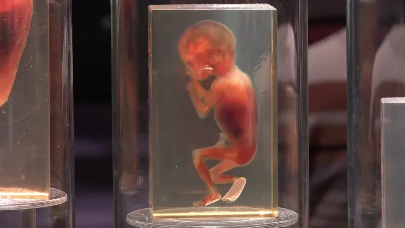 Without Medication: Traditional Home Abortion Methods in Afghanistan