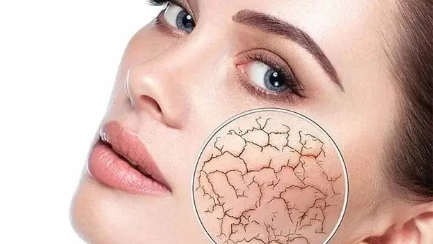 “Magical” Fruit: An Effective Solution for Hydrating Skin in Winter