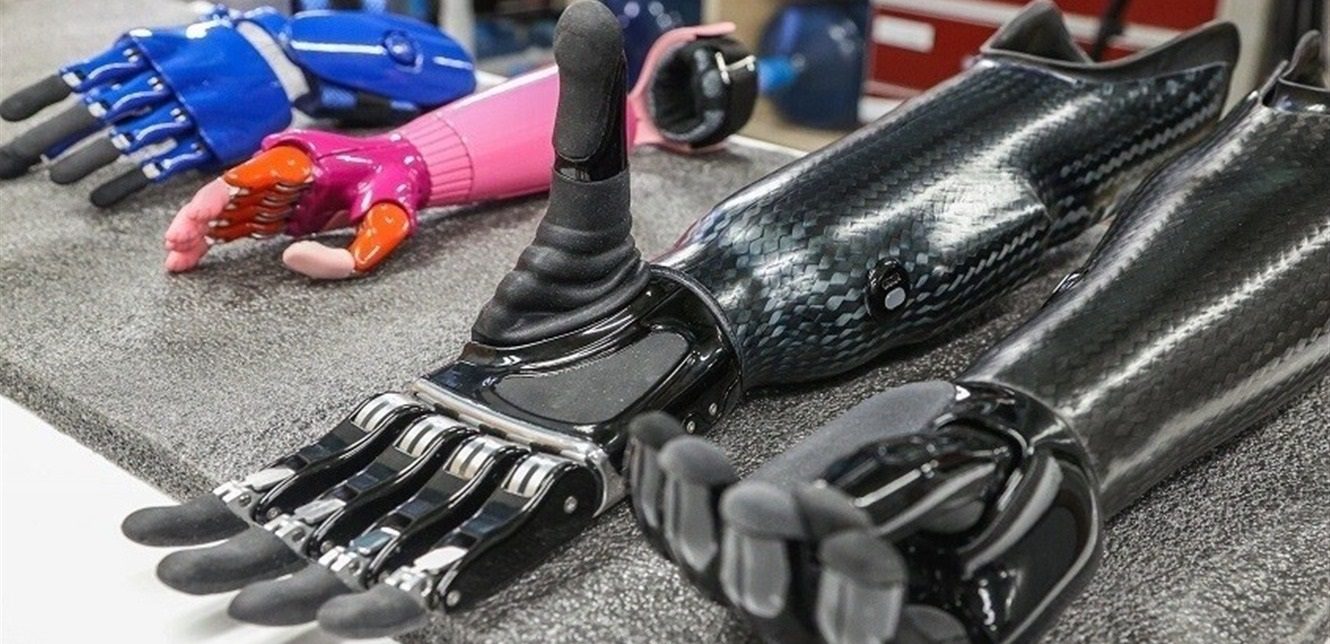 روسيا: تقنية جديدة لأطراف اصطناعية ذات عمر مديد