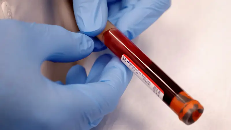 تقرير يكشف: اختبار دم حديث يتوقع الإصابة بالأمراض قبل عشر سنوات