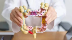 Discovering a new mechanism to combat colon cancer