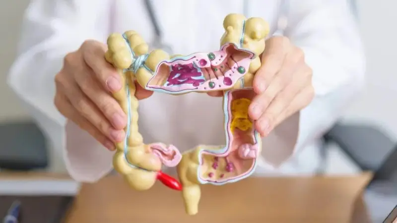 South Korea: Discovering a new mechanism to combat colon cancer