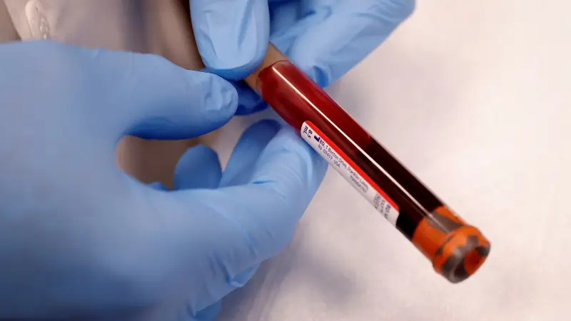 A single blood test: Does it hold the key to detecting Alzheimer's?
