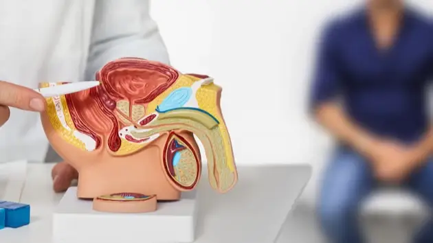 بلاستيك في غدة البروستاتا: نتائج مذهلة تثير مخاوف جدية