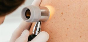 An application that detects “the most dangerous skin cancers”. Find out the details